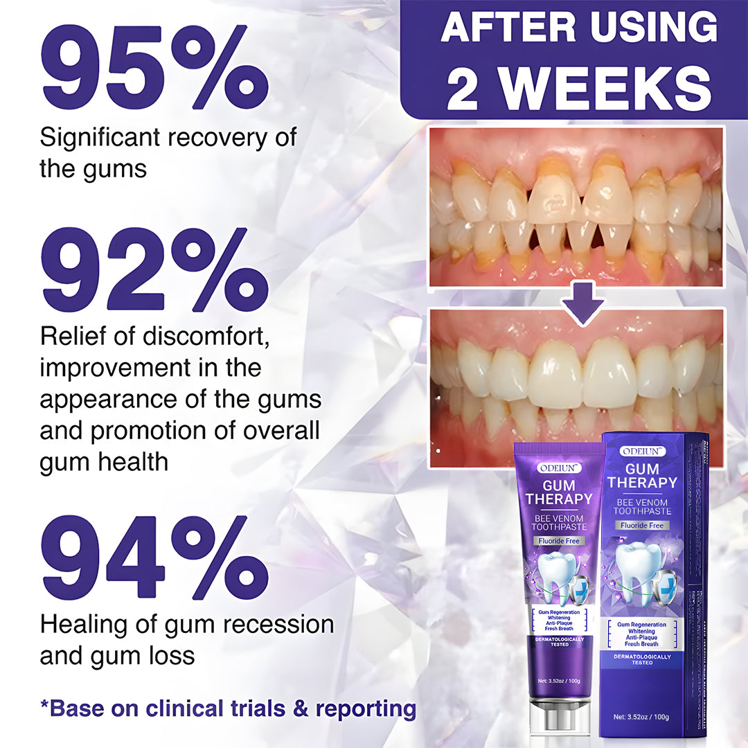 ODEIUN™ Bee Venom Dental Treatment Toothpaste